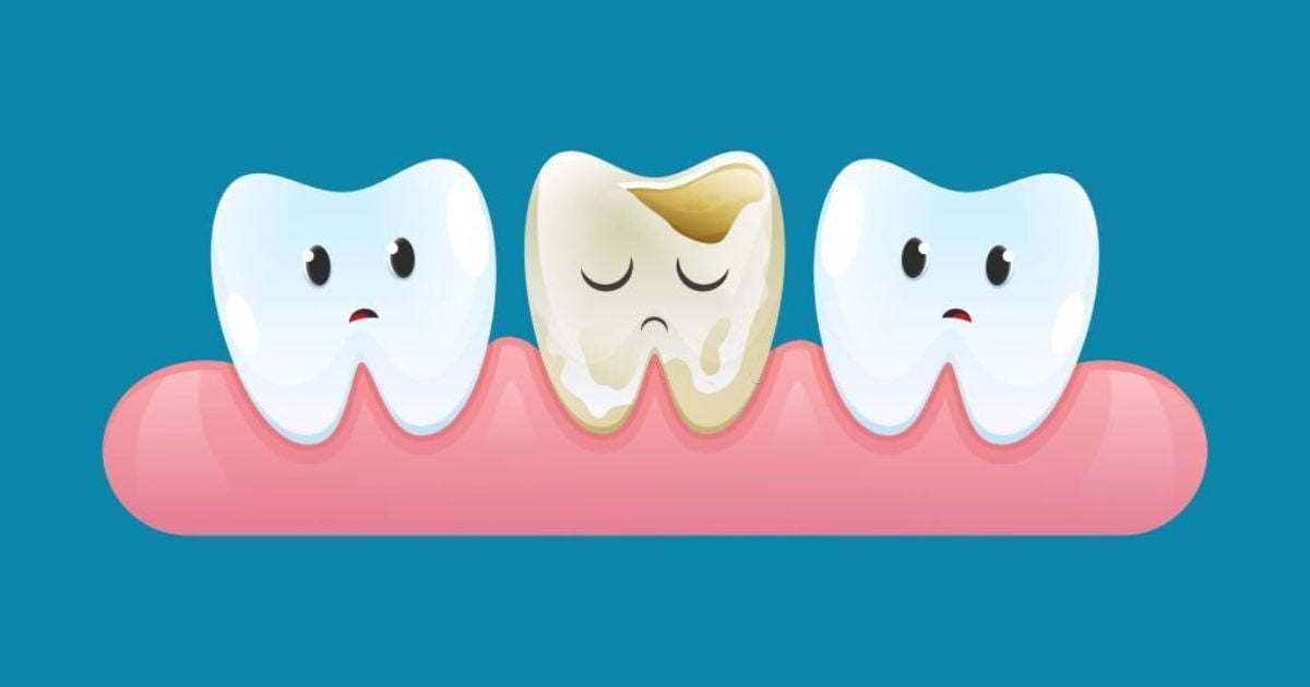 What does it mean when you dream about a broken tooth?